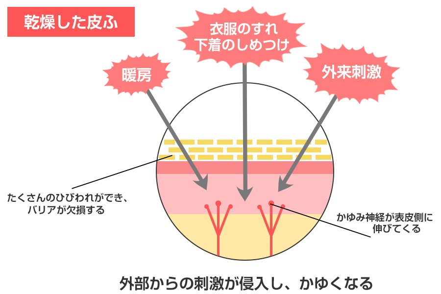 あかぎれ かかと