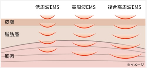 EMS�̎��