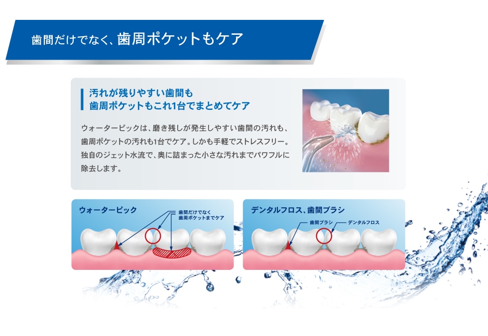 口腔洗浄機器【乾電池式】 | ウォーターピック | WF-03J010 | Joshin