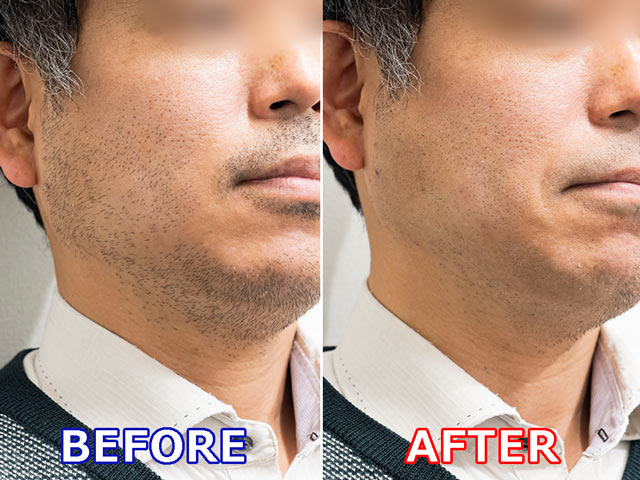 直感的に剃れるのがパームインの好きなところです