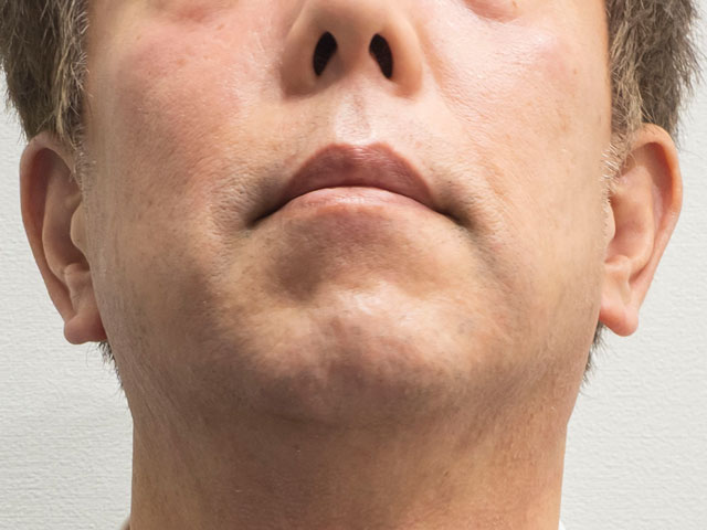使用後のヒリヒリ感は無し